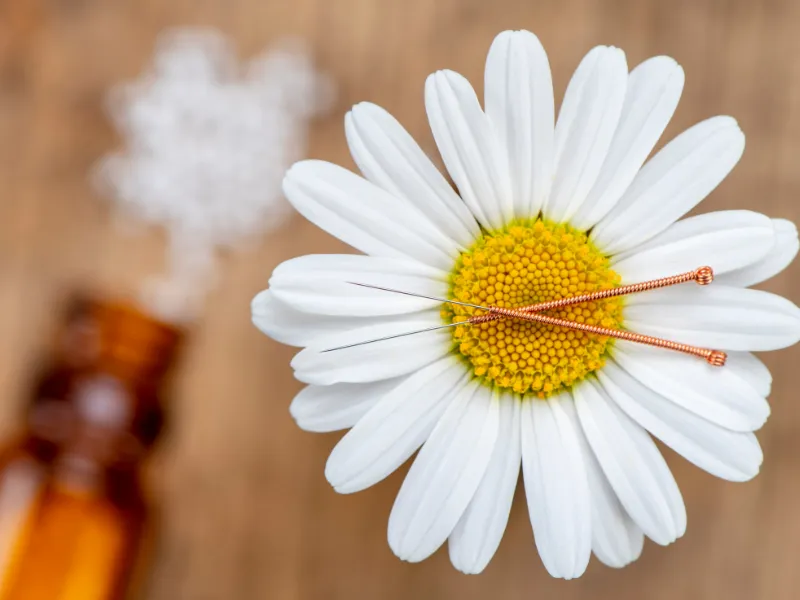 Akupunktur – GynBodensee Immenstaad